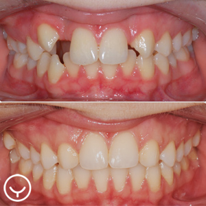 Yul Ortho