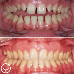 Yul Ortho
