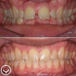 Yul Ortho